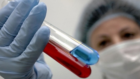 В России утвердили стратегию противодействия ВИЧ-инфекции до 2020 года