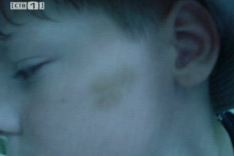 Отдых в Таганроге для 9-летнего сургутянина закончился побоями