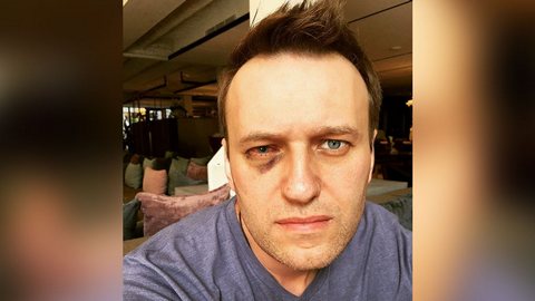 Алексею Навальному в Испании сделали операцию на глазу, который пострадал от зеленки после нападения