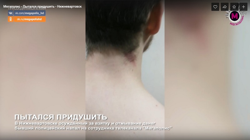 Новое нападение на  журналистов в Югре: пострадал оператор из Нижневартовска