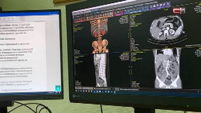 В Тюменской больнице вводят новую технологию описания снимков рентгена и КТ