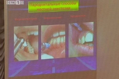В Сургуте стоматологи обсуждают проблемы обезболивания