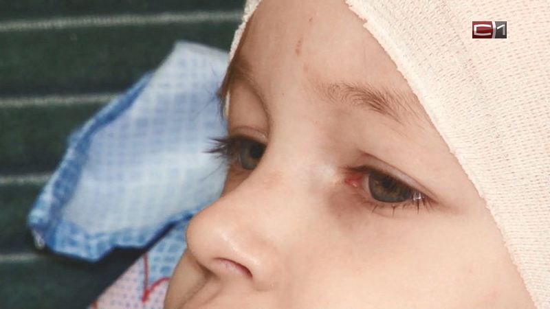 Программу медпомощи детям с редкими заболеваниями разрабатывают в Тюменской области