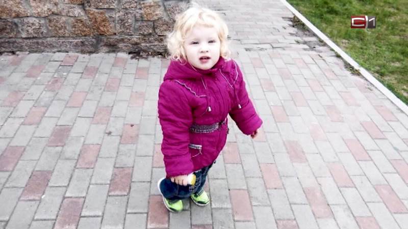 Дети-альбиносы: как они рождаются у здоровых родителей и с какими трудностями живут