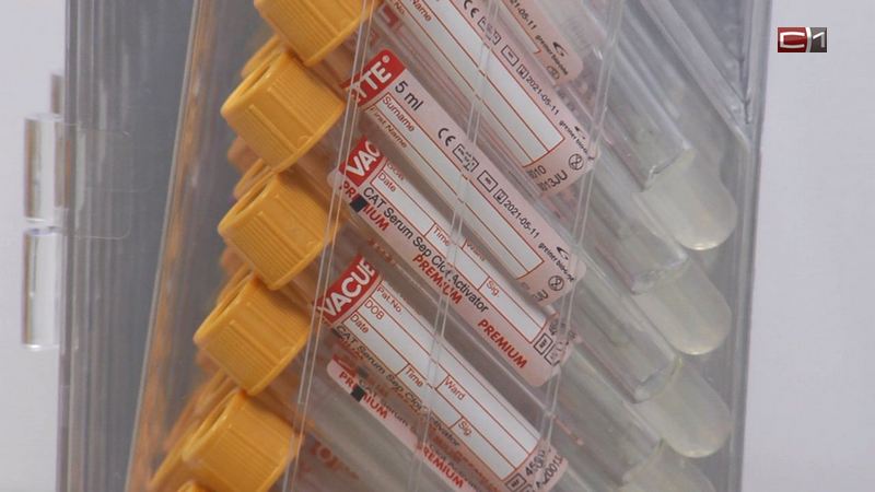 Более 50 случаев коронавирусной инфекции зафиксировано в Югре за сутки