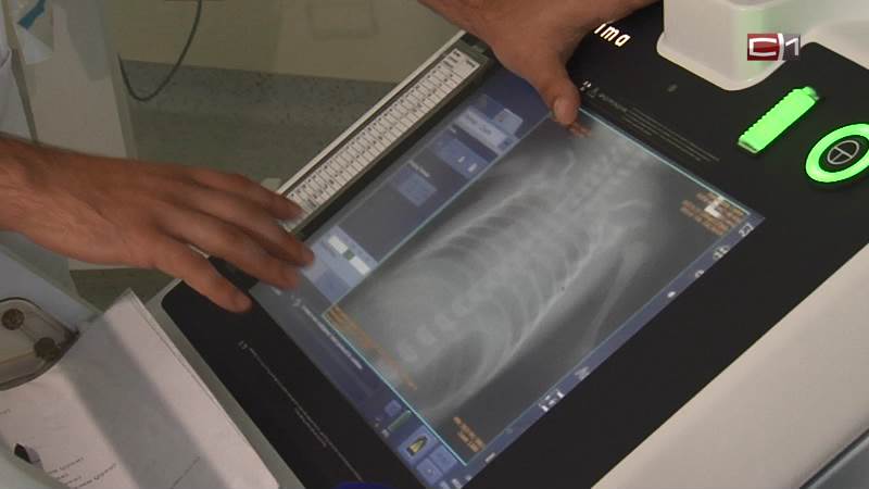В Югре закрыли рентген-кабинет из-за угрозы облучения персонала