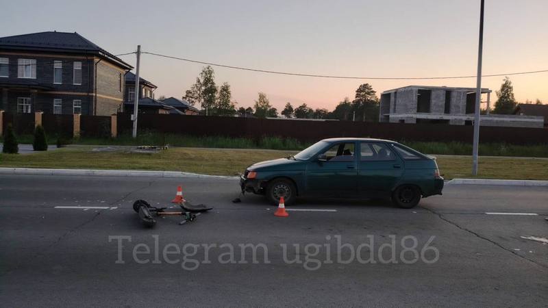 В Югре юные велосипедист и самокатчик получили травмы в ДТП