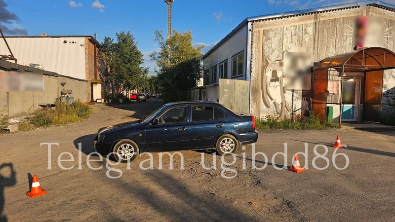 В Сургутском районе пенсионер скончался в больнице после ДТП