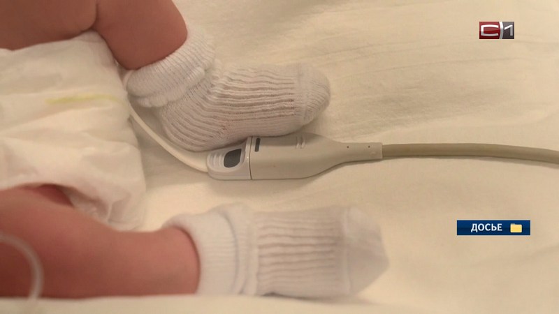 В Сургуте врачи сделали новорожденному ребенку сложную операцию на сердце