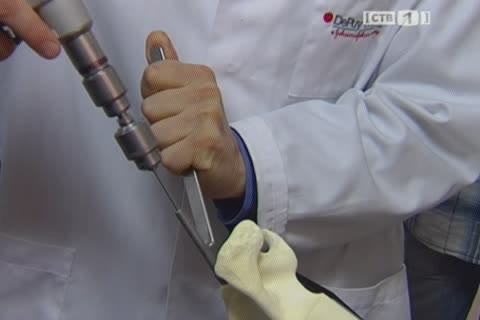 Сургутские хирурги освоили протезирование плечевых суставов