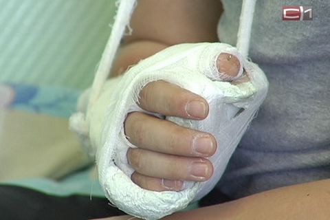Хирурги Сургута восстановили палец руки