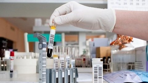В Югре зарегистрирована вторая вспышка серозного менингита