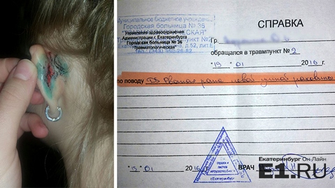 В Екатеринбурге воспитатель детсада порвала ребенку ухо. Инцидент произошел во время утренней зарядки